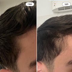 תמונת לפני אחרי שימוש בטרייב של הרמוני