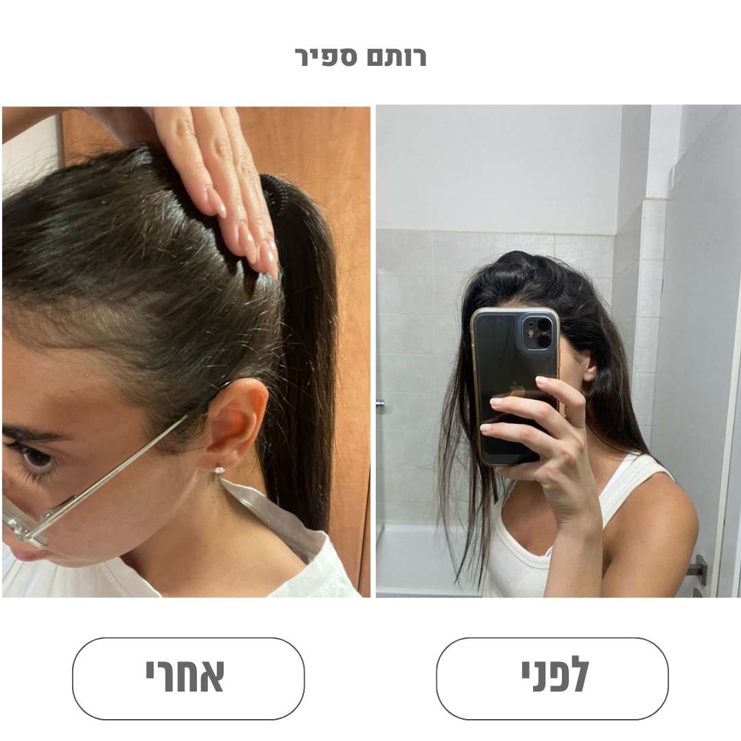 תוצאה של לקוח שמשתמש בהרמוני ומציג תמונת לפני ואחרי