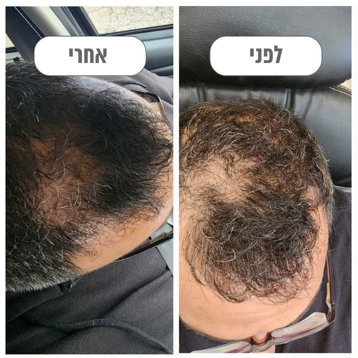 Thrive - למניעת נשירה וחיזוק שיער הגבר